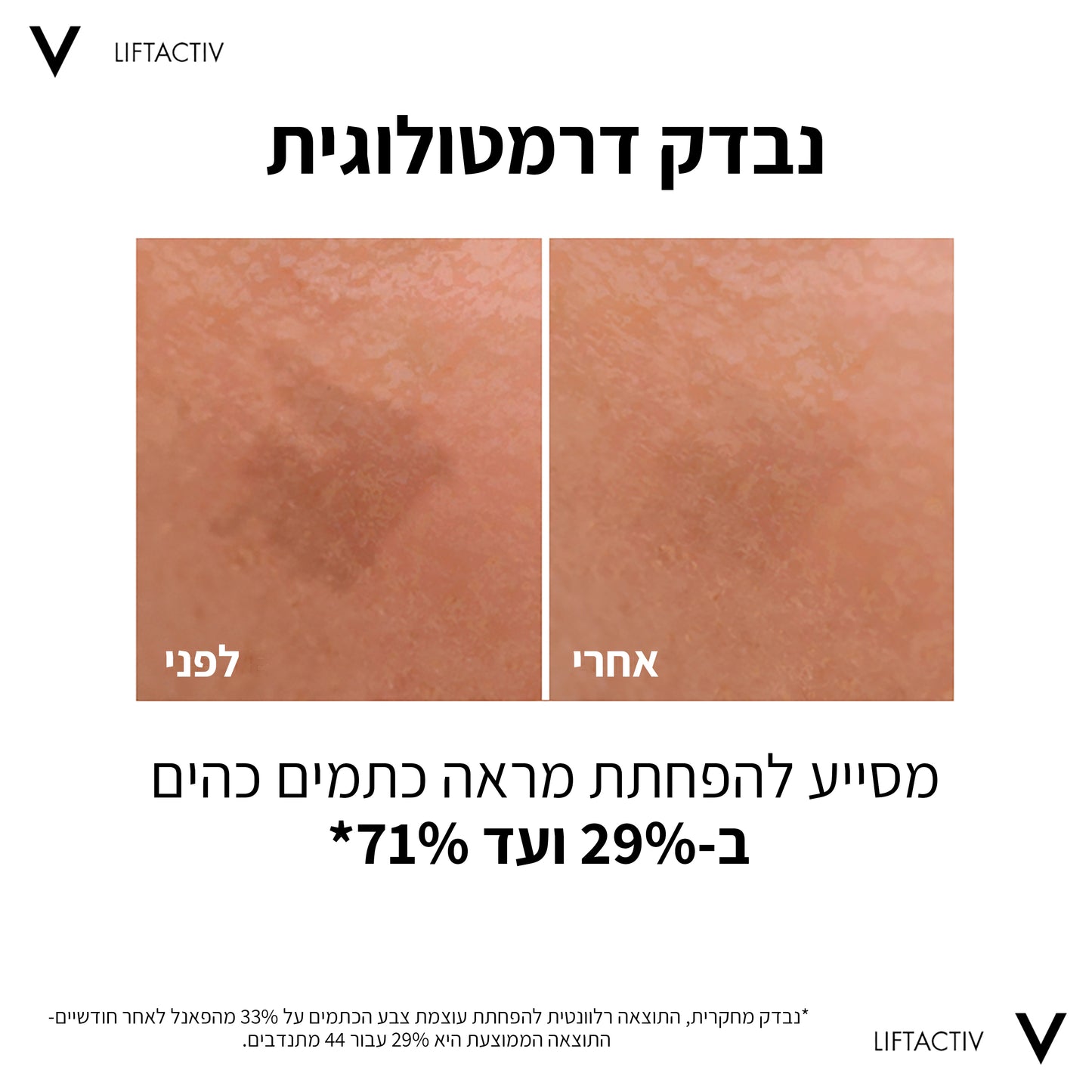 וישי ליפטאקטיב B3 סרום 30 מ"ל