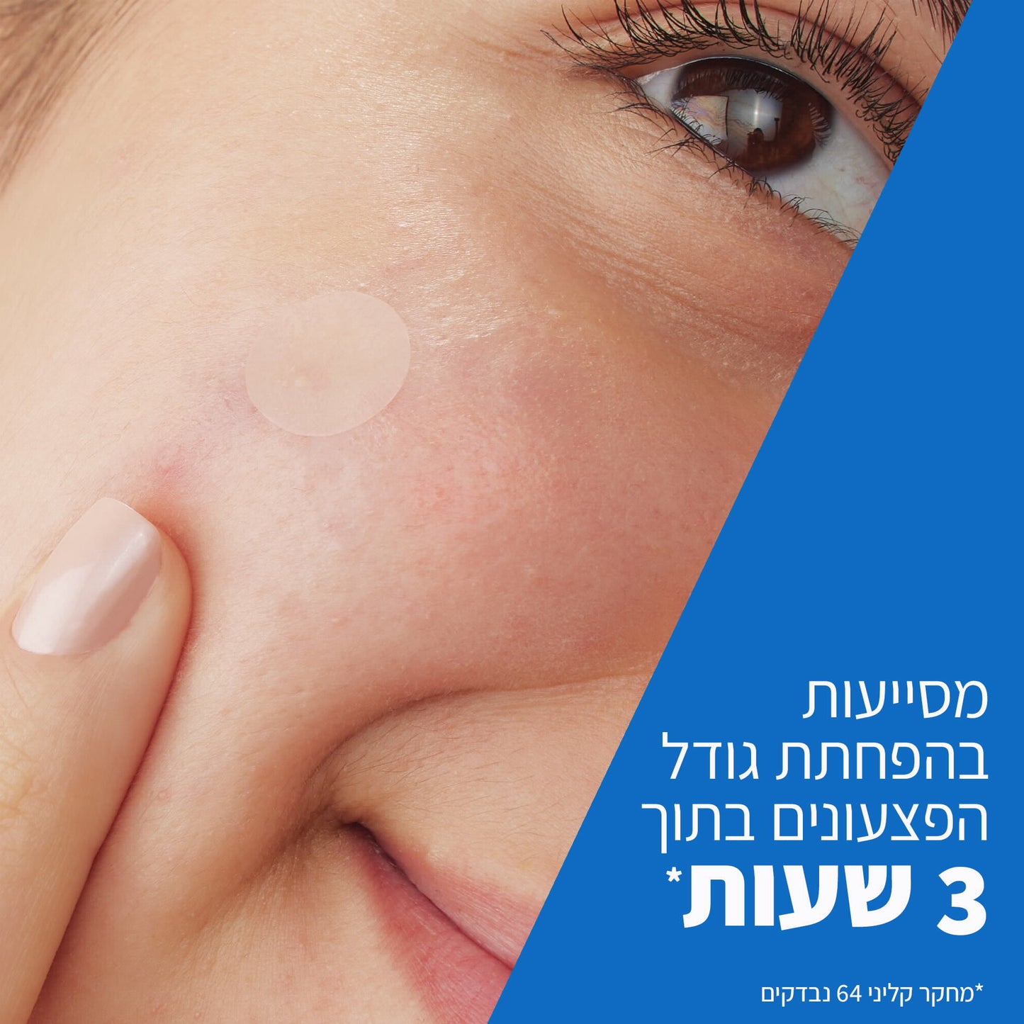סרווה מדבקות נגד מראה פגמי עור